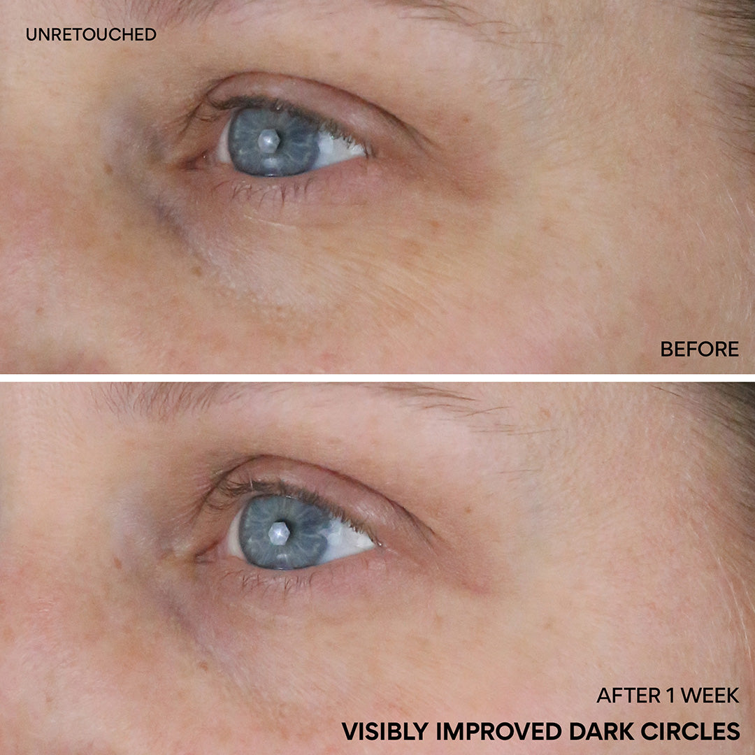 Vitamin C Niacinamide Brightening Eye Serum