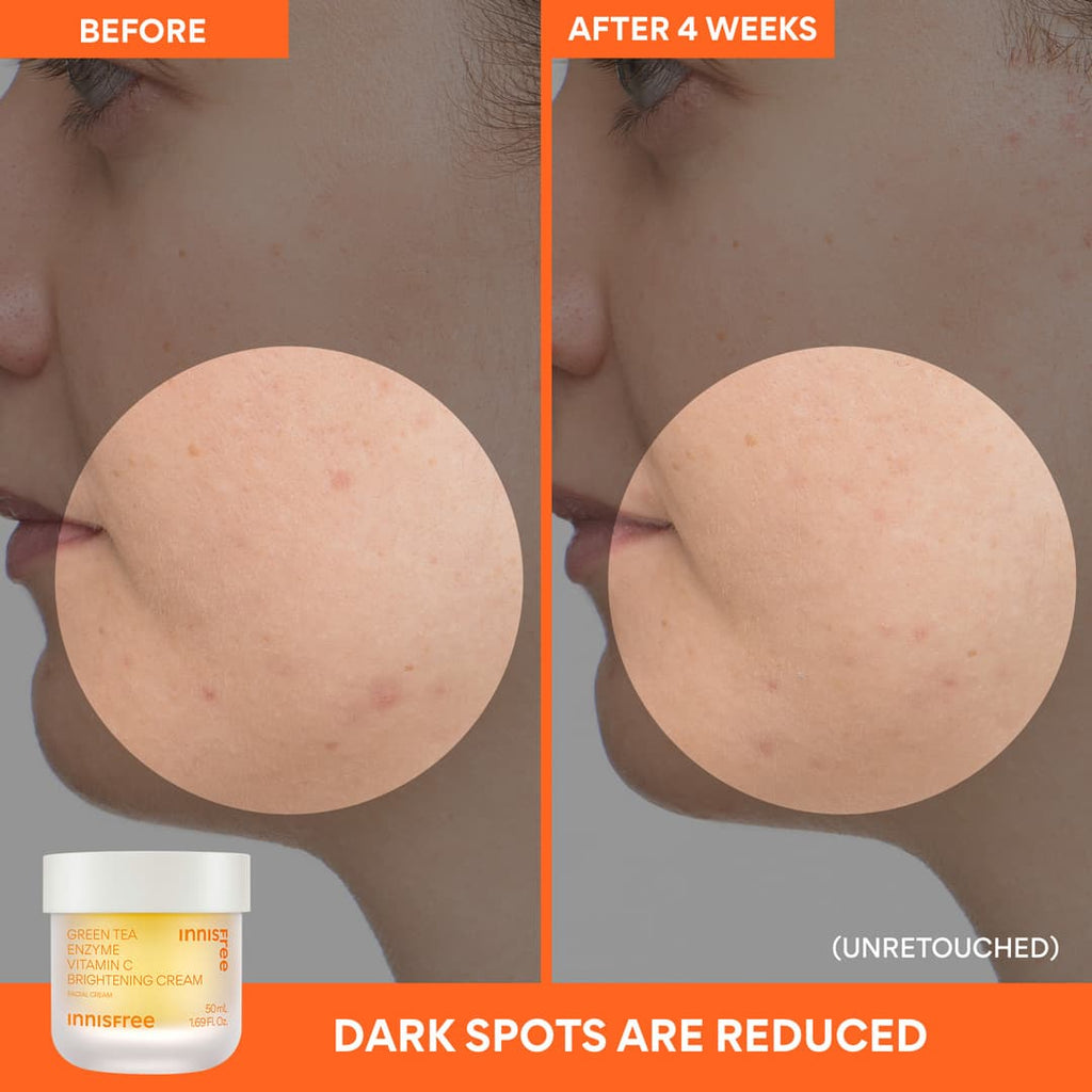 Green Tea Enzyme Vitamin C Brightening Cream